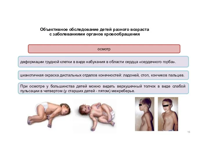 Объективное обследование детей разного возраста с заболеваниями органов кровообращения осмотр деформации грудной