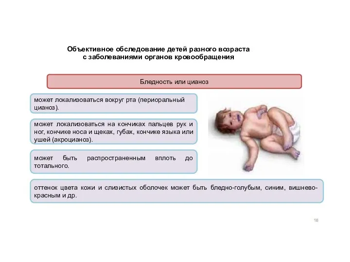 Объективное обследование детей разного возраста с заболеваниями органов кровообращения Бледность или цианоз