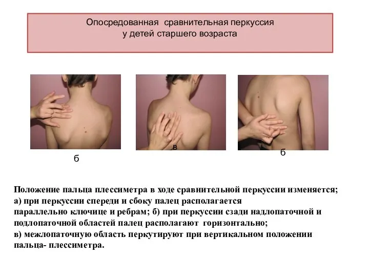 Опосредованная сравнительная перкуссия у детей старшего возраста Положение пальца плессиметра в ходе