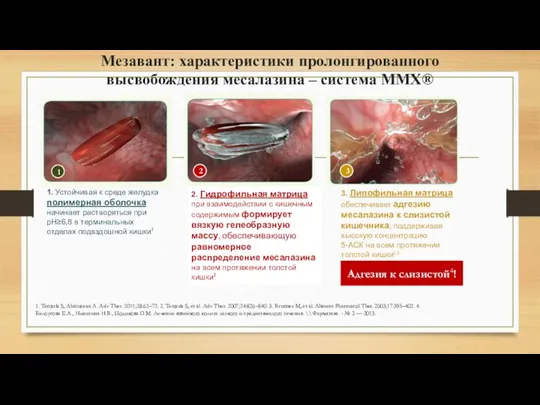 Мезавант: характеристики пролонгированного высвобождения месалазина – система MMX® 2. Гидрофильная матрица при