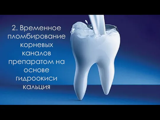 2. Временное пломбирование корневых каналов препаратом на основе гидроокиси кальция