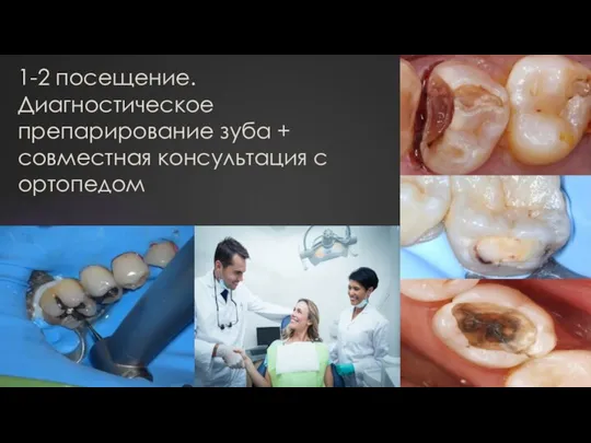 1-2 посещение. Диагностическое препарирование зуба + совместная консультация с ортопедом
