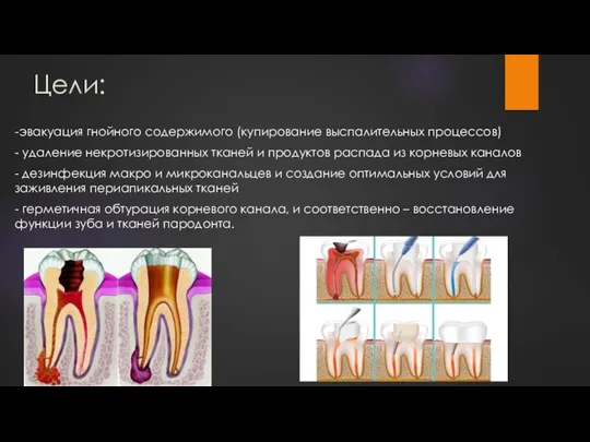 Цели: -эвакуация гнойного содержимого (купирование выспалительных процессов) - удаление некротизированных тканей и