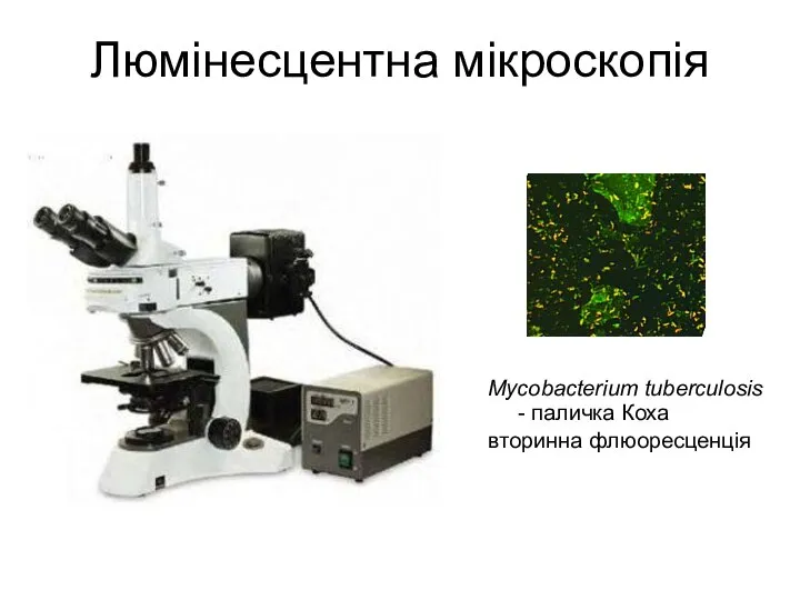 Люмінесцентна мікроскопія Mycobacterium tuberculosis - паличка Коха вторинна флюоресценція