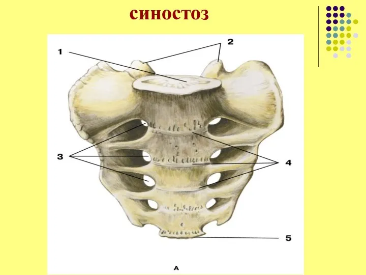 синостоз