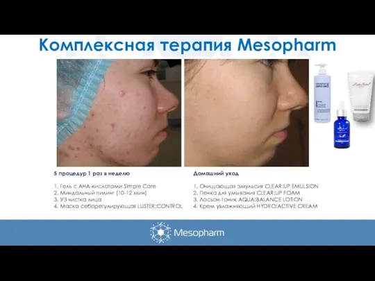 Комплексная терапия Mesopharm 5 процедур 1 раз в неделю 1. Гель с