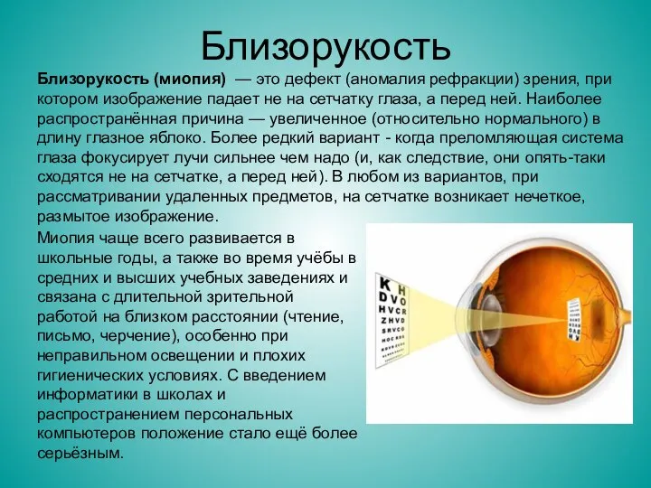 Близорукость Близорукость (миопия) — это дефект (аномалия рефракции) зрения, при котором изображение