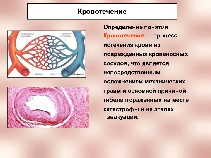 Кровотечение Определение понятия. Кровотечение — процесс истечения крови из поврежденных кровеносных сосудов,