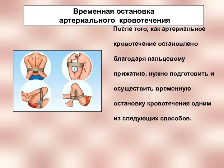 Временная остановка артериального кровотечения После того, как артериальное кровотечение остановлено благодаря пальцевому