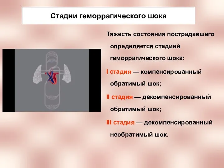 Стадии геморрагического шока Тяжесть состояния пострадавшего определяется стадией геморрагического шока: I стадия