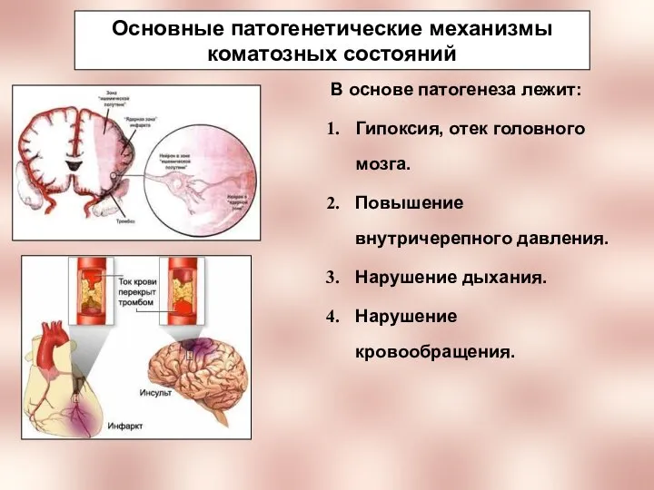 Основные патогенетические механизмы коматозных состояний В основе патогенеза лежит: Гипоксия, отек головного