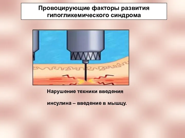 Провоцирующие факторы развития гипогликемического синдрома Нарушение техники введения инсулина – введение в мышцу.