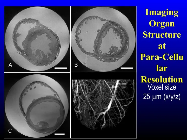 Imaging Organ Structure at Para-Cellular Resolution Voxel size 25 μm (x/y/z)