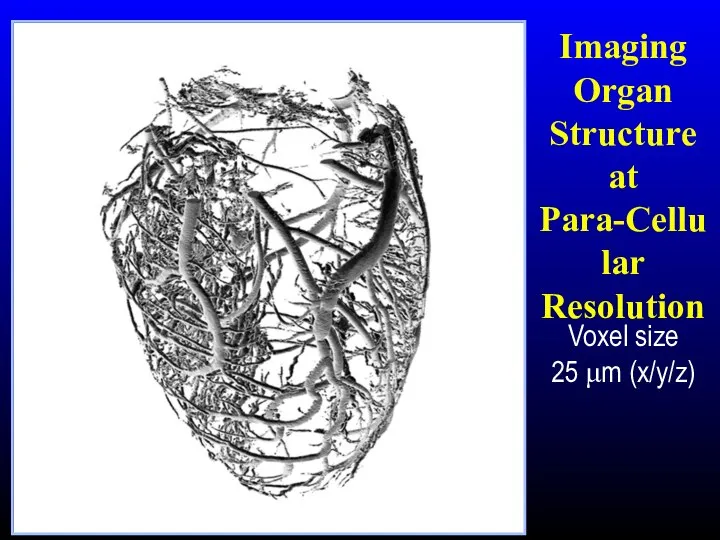 Voxel size 25 μm (x/y/z) Imaging Organ Structure at Para-Cellular Resolution