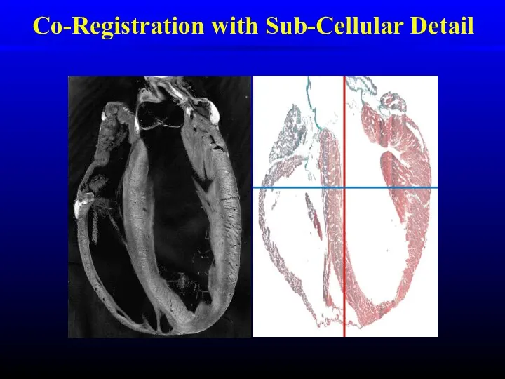 Co-Registration with Sub-Cellular Detail