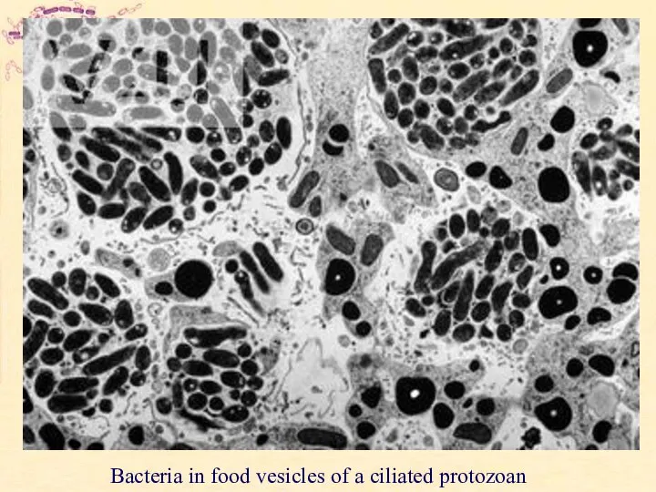 Bacteria in food vesicles of a ciliated protozoan
