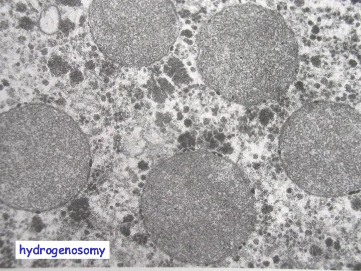 hydrogenosomy