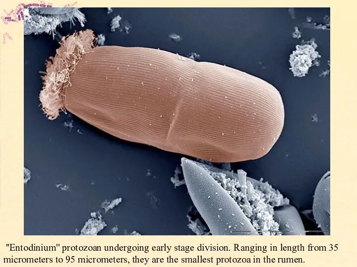 ''Entodinium'' protozoan undergoing early stage division. Ranging in length from 35 micrometers