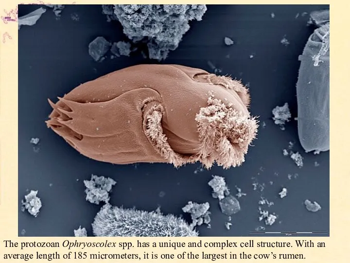 The protozoan Ophryoscolex spp. has a unique and complex cell structure. With