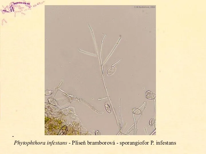 Phytophthora infestans - Plíseň bramborová - sporangiofor P. infestans