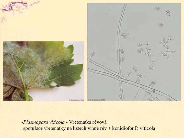Plasmopara viticola - Vřetenatka révová sporulace vřetenatky na listech vinné rév + konidiofor P. viticola