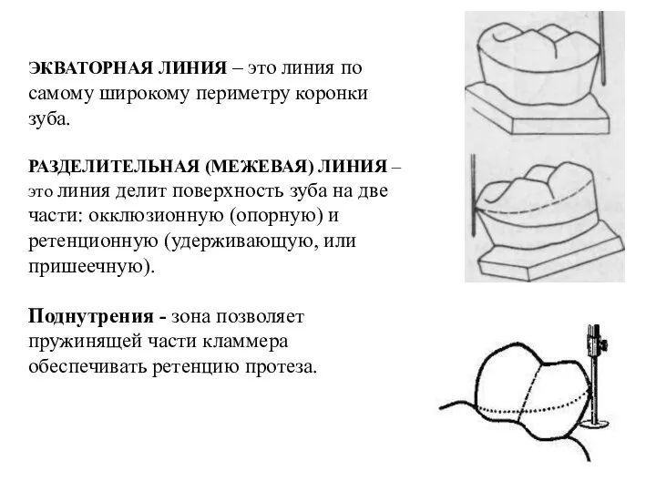 ЭКВАТОРНАЯ ЛИНИЯ – это линия по самому широкому периметру коронки зуба. РАЗДЕЛИТЕЛЬНАЯ