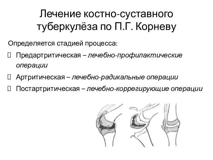 Лечение костно-суставного туберкулёза по П.Г. Корневу Определяется стадией процесса: Предартритическая – лечебно-профилактические