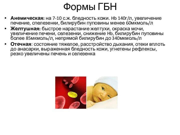 Формы ГБН Анемическая: на 7-10 с.ж. бледность кожи. Hb 140г/л, увеличение печение,