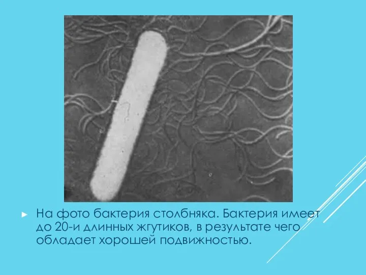 На фото бактерия столбняка. Бактерия имеет до 20-и длинных жгутиков, в результате чего обладает хорошей подвижностью.
