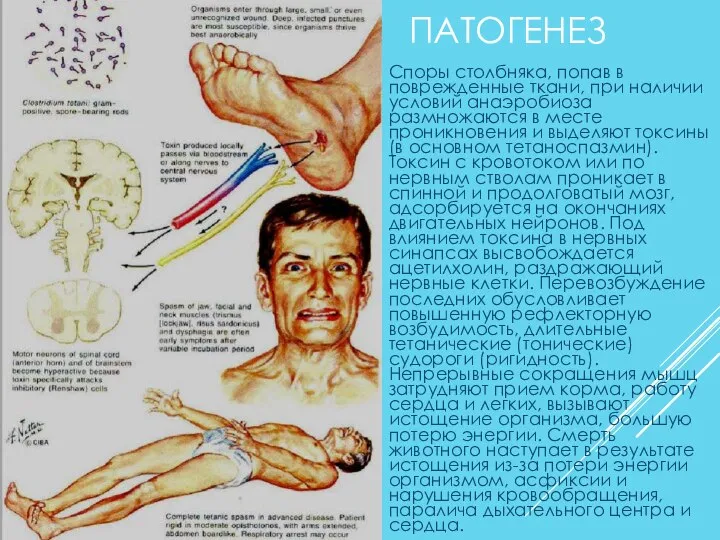 ПАТОГЕНЕЗ Споры столбняка, попав в поврежденные ткани, при наличии условий анаэробиоза размножаются