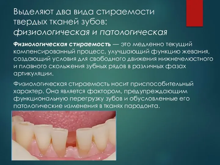 Выделяют два вида стираемости твердых тканей зубов: физиологическая и патологическая Физиологическая стираемость