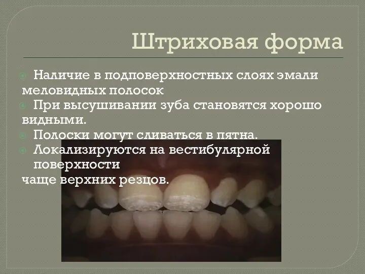 Штриховая форма Наличие в подповерхностных слоях эмали меловидных полосок При высушивании зуба