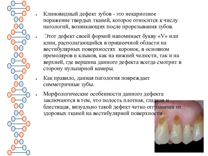Клиновидный дефект зубов - это некариозное поражение твердых тканей, которое относится к