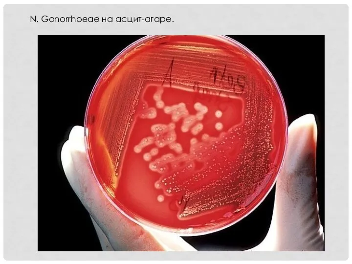 N. Gonorrhoeae на асцит-агаре.