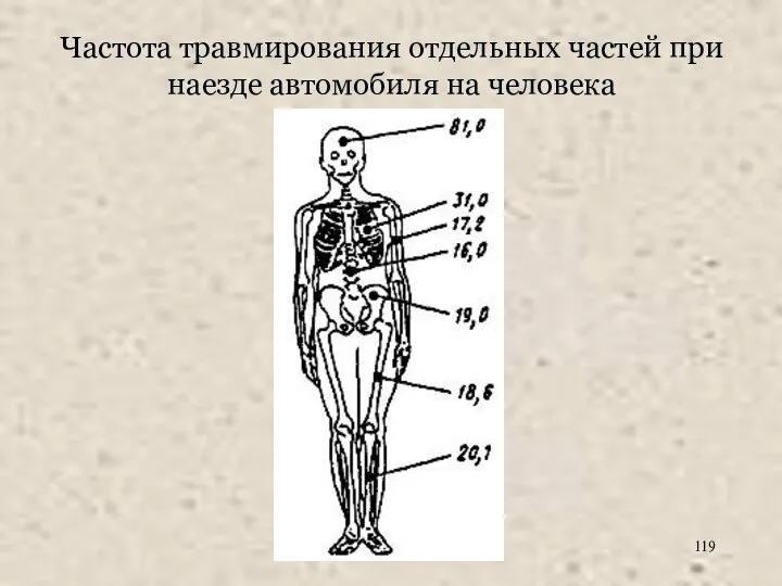 Частота травмирования отдельных частей при наезде автомобиля на человека