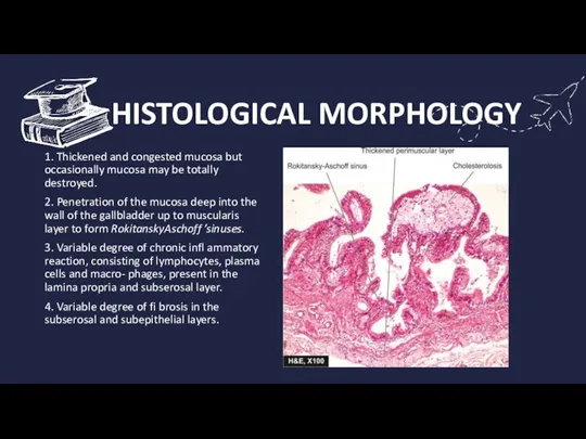 HISTOLOGICAL MORPHOLOGY 1. Thickened and congested mucosa but occasionally mucosa may be
