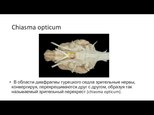 Chiasma opticum В области диафрагмы турецкого седла зрительные нервы, конвергируя, перекрещиваются друг