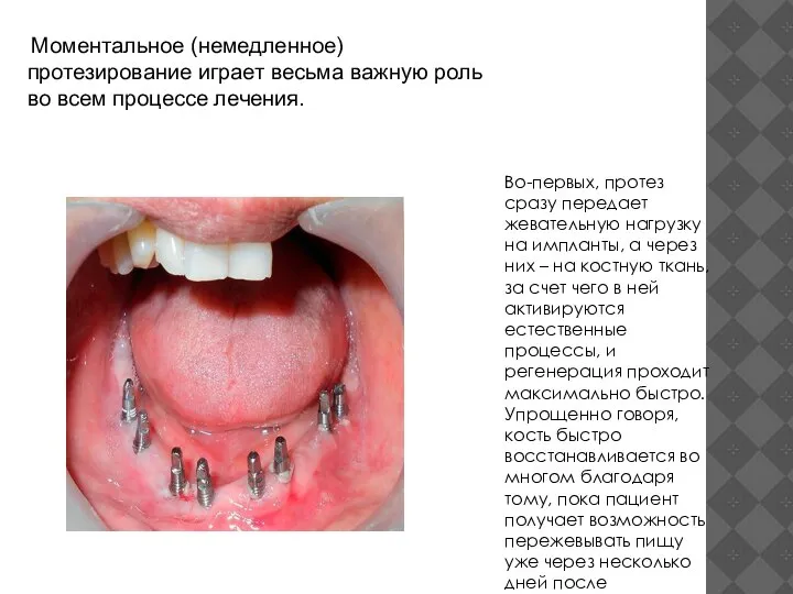 Во-первых, протез сразу передает жевательную нагрузку на импланты, а через них –