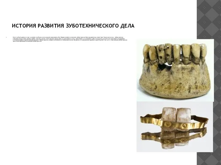 ИСТОРИЯ РАЗВИТИЯ ЗУБОТЕХНИЧЕСКОГО ДЕЛА Ещё в глубокой древности люди осознавали необходимость возмещения