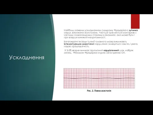 Ускладнення Найбільш важким ускладненням синдрому Фредеріка є зупинка серця, викликана асистолією. Частіше