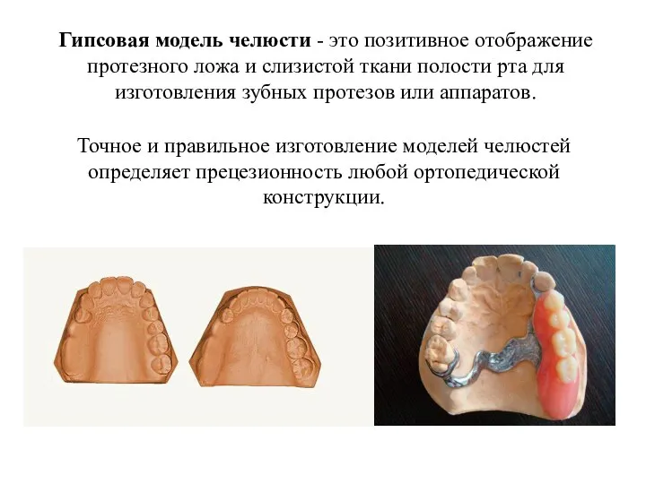 Гипсовая модель челюсти - это позитивное отображение протезного ложа и слизистой ткани