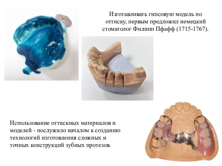 Изготавливать гипсовую модель по оттиску, первым предложил немецкий стоматолог Филипп Пфафф (1715-1767).