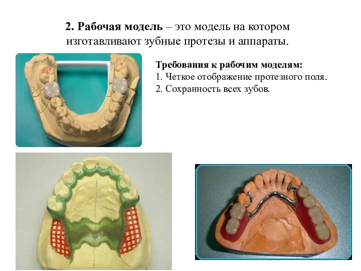 2. Рабочая модель – это модель на котором изготавливают зубные протезы и