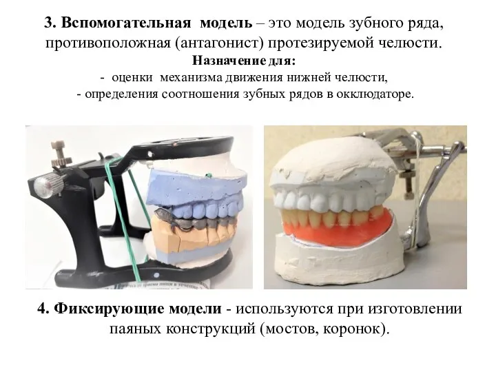 3. Вспомогательная модель – это модель зубного ряда, противоположная (антагонист) протезируемой челюсти.