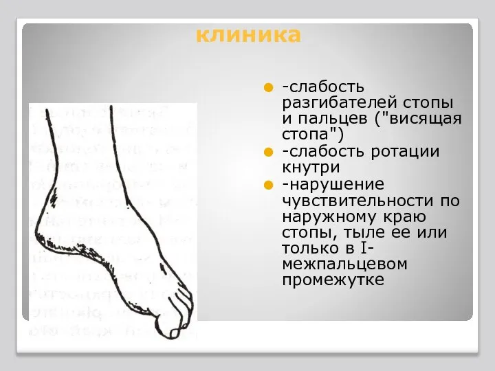 клиника -слабость разгибателей стопы и пальцев ("висящая стопа") -слабость ротации кнутри -нарушение