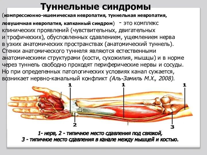 Туннельные синдромы (компрессионно-ишемическая невропатия, туннельная невропатия, ловушечная невропатия, капканный синдром) - это