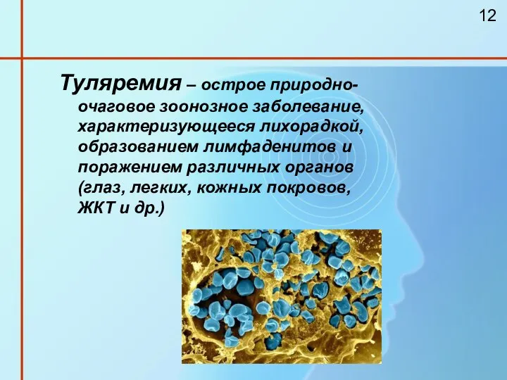 Туляремия – острое природно-очаговое зоонозное заболевание, характеризующееся лихорадкой, образованием лимфаденитов и поражением