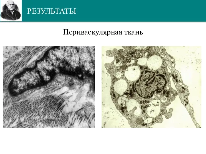 РЕЗУЛЬТАТЫ Периваскулярная ткань