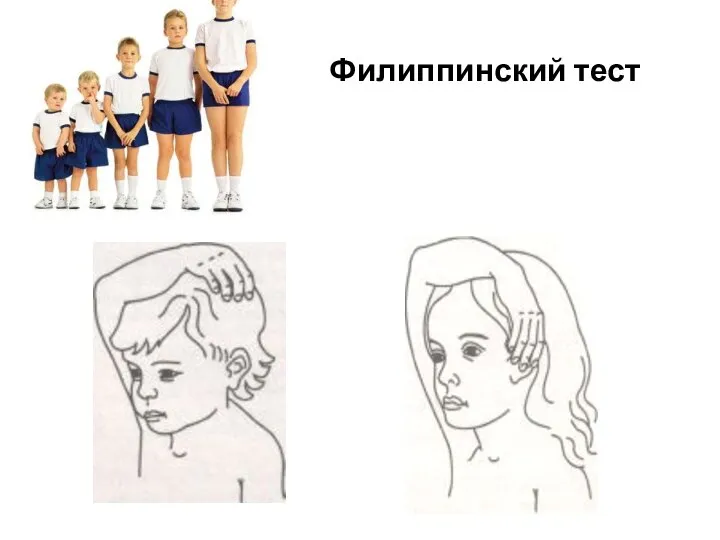 Филиппинский тест