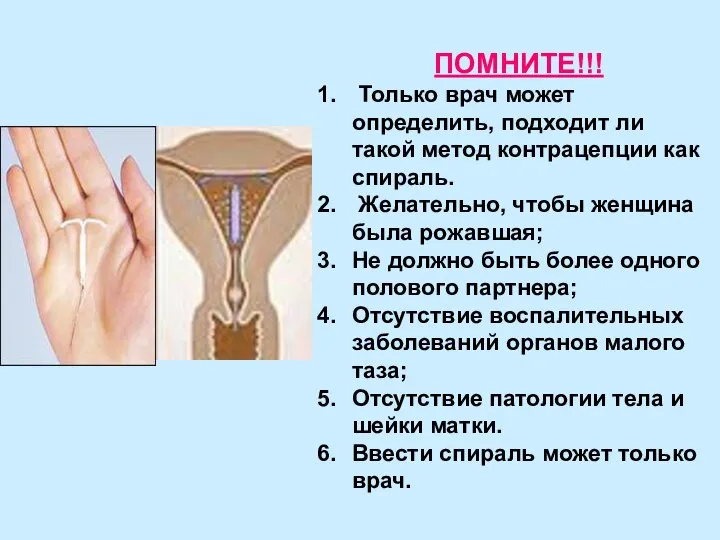 ПОМНИТЕ!!! Только врач может определить, подходит ли такой метод контрацепции как спираль.